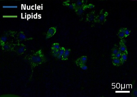 Label-free SRS cytology: nuclei and lipids