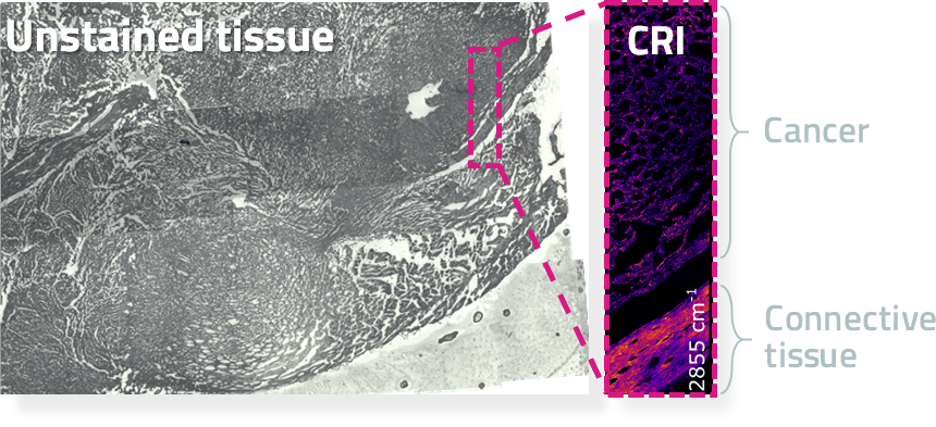 Tissue high resolution Tissue high resolution