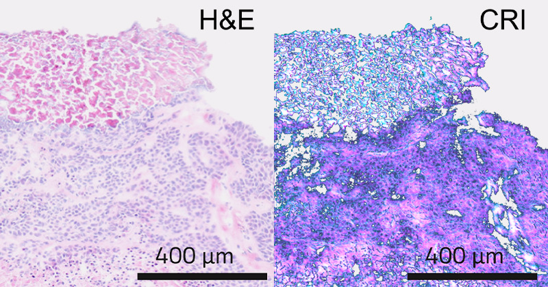 CRI presents project Mindset, the future of virtual histopathology