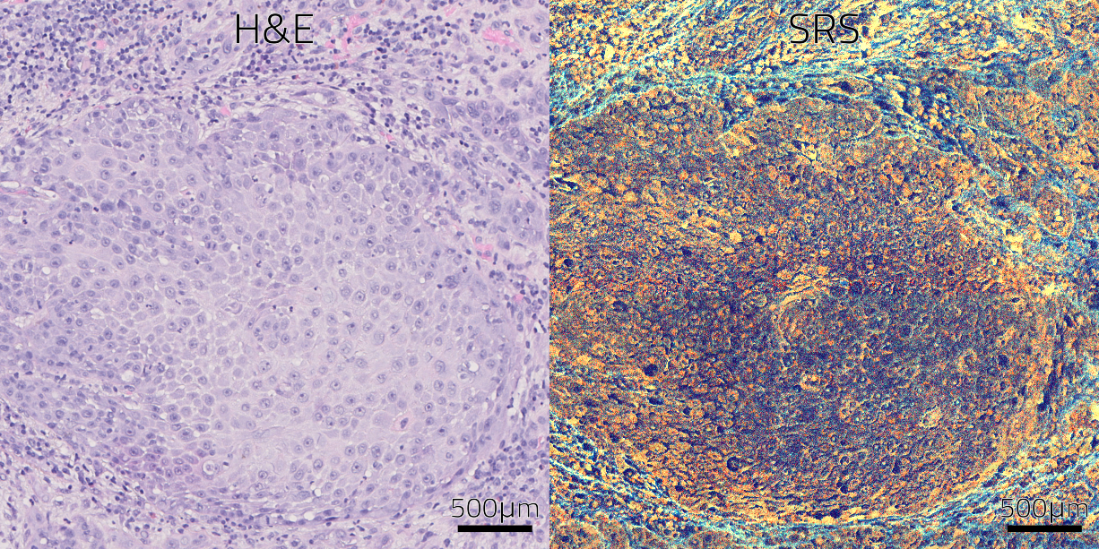 Label-free histopathology tissue imaging
