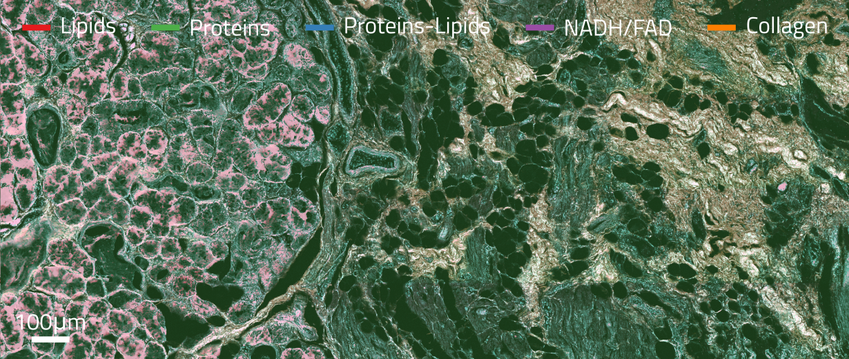 Label-free histopathology tissue imaging