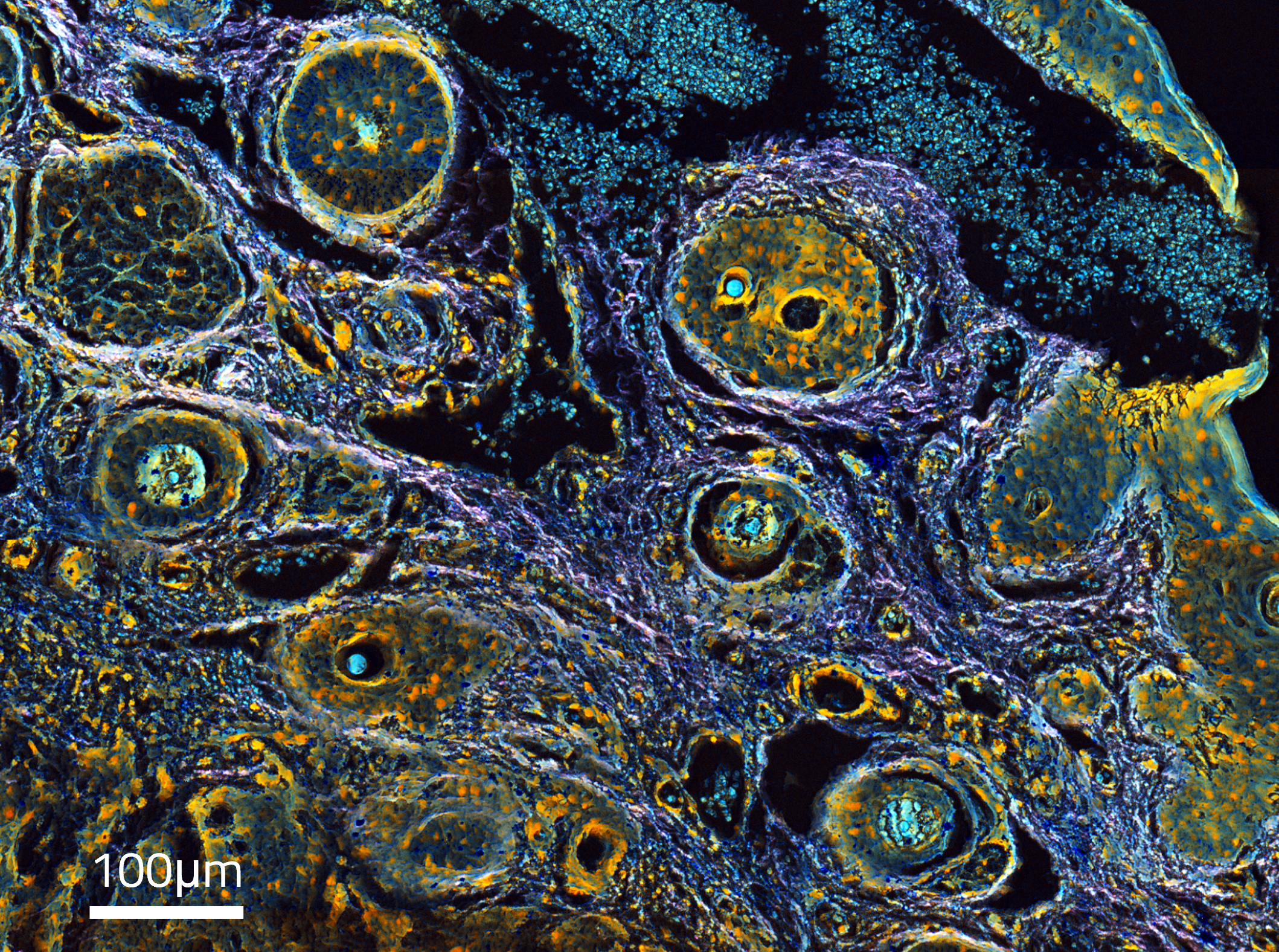 Label-free histopathology tissue imaging